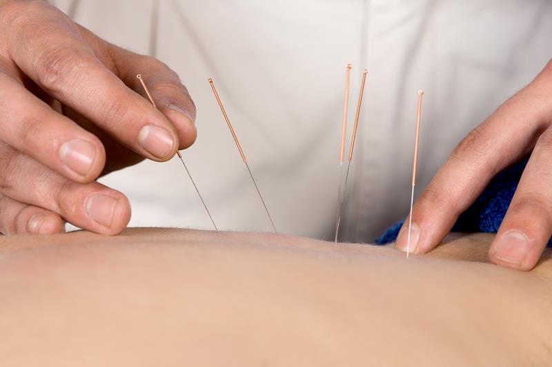 Acupuncture  Decatur, IL